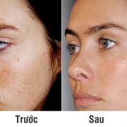 Set Caudalie Vinoperfect 3 món dưỡng trắng mờ vết thâm