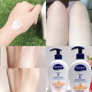 Sữa dưỡng thể Redwin Vitamin E Body Lotion Úc 400ml
