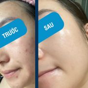 Mặt nạ cấp ẩm phục hồi da B5 Yuejin Repair Control EGF