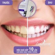 ​Kem đánh răng than hoạt tính Crest 3D Therapy của Mỹ