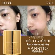 Kem trị nám trắng da Vanntio MelaWhite của Hàn Quốc