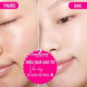 Viên uống W Skin Retinol Kwangwoon 90 viên của Hàn