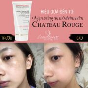 Kem dưỡng trắng da trị thâm nám Chateau Rouge 50ml