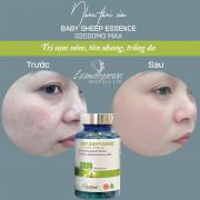 Nhau thai cừu Baby Sheep Essence Careline của Úc 200 viên