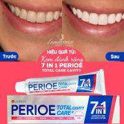 Kem đánh răng Perioe 7 in 1 Total Care Cavity của Hàn Quốc