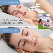 Miếng dán miệng chống ngáy Mouth Strips Farrinne của Mỹ
