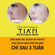 Serum dưỡng trắng phục hồi da Tiam Vita B3 Source 40ml