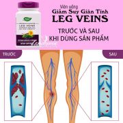 Viên hỗ trợ điều trị suy giãn tĩnh mạch Nature’s Way Leg Veins