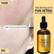Serum chống lão hóa Pure Retinol High Class Nhật Bản 60ml 