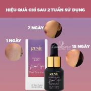 Tinh chất tái tạo da Genie Derma Matrix Peel Solution 15ml
