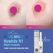 Kem làm hồng nhũ hoa Nuwhite N1 Mibiti Prudente chính hãng