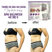 Miếng dán tan mỡ bụng Spa Gel Patch 42 độ C từ Hàn Quốc