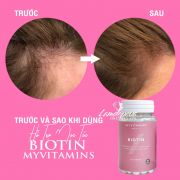 Viên uống mọc tóc Biotin Myvitamins 90 viên của Anh Quốc