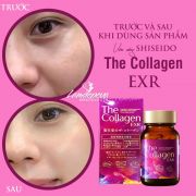 Viên uống The Collagen EXR Shiseido 126 viên mẫu mới nhất