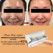 Nhau thai ngựa chiến Mongolia Placenta Liquid 30 ống Nhật Bản