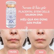 Tế bào gốc Placental Stem Cells Salmon DNA của Hàn Quốc 5 lọ