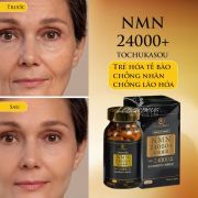NMN 24000+ Tochukasou Nhật Bản 90 viên trẻ hóa tế bào