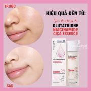 Nước thần Glutathione Niacinamide Cica Essence 150ml Hàn Quốc