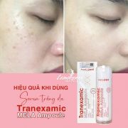Serum trắng da mờ thâm Tranexamic Mela Ampoule 30ml
