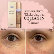 Tinh chất chống nhăn Costar Collagen Essence 150ml của Úc