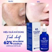Serum 62% Hyaluron Complex Ampoule Histolab Hàn Quốc
