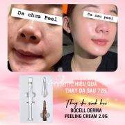 Thay da sinh học Bqcell Peeling Derma Cream của Hàn Quốc