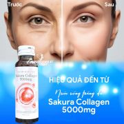 Nước uống Sakura Collagen 5000mg của Nhật Bản 10 chai